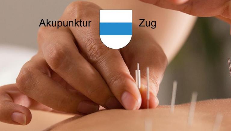 Akupunktur Zug