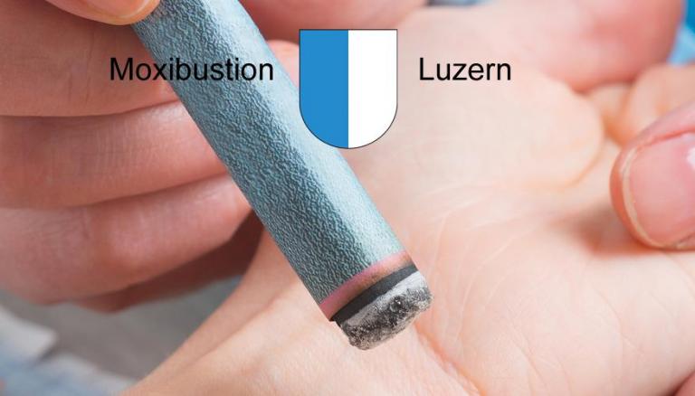 Moxibustion Luzern