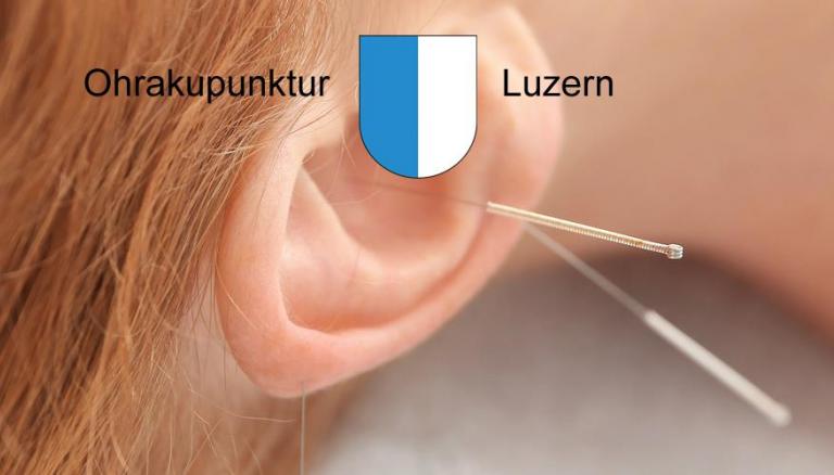 Ohrakupunktur Luzern